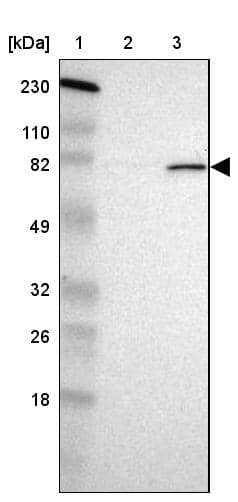 POMT2 Antibody - BSA Free Western Blot: POMT2 Antibody - BSA Free [NBP1-86152]