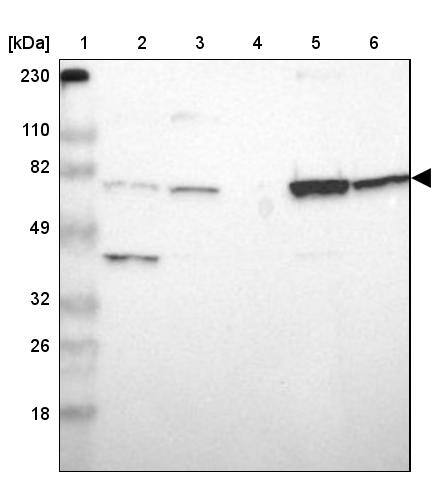 ASMTL Antibody - BSA Free Western Blot: ASMTL Antibody - BSA Free [NBP1-86154]