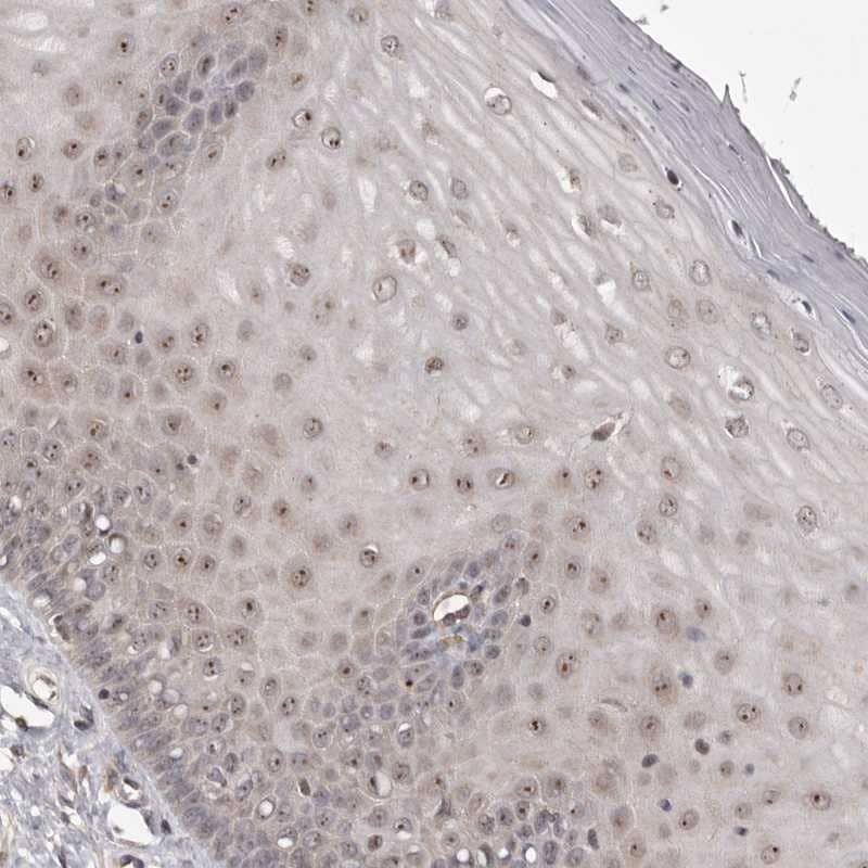 NOL12 Antibody - BSA Free Immunohistochemistry-Paraffin: NOL12 Antibody [NBP1-86155]
