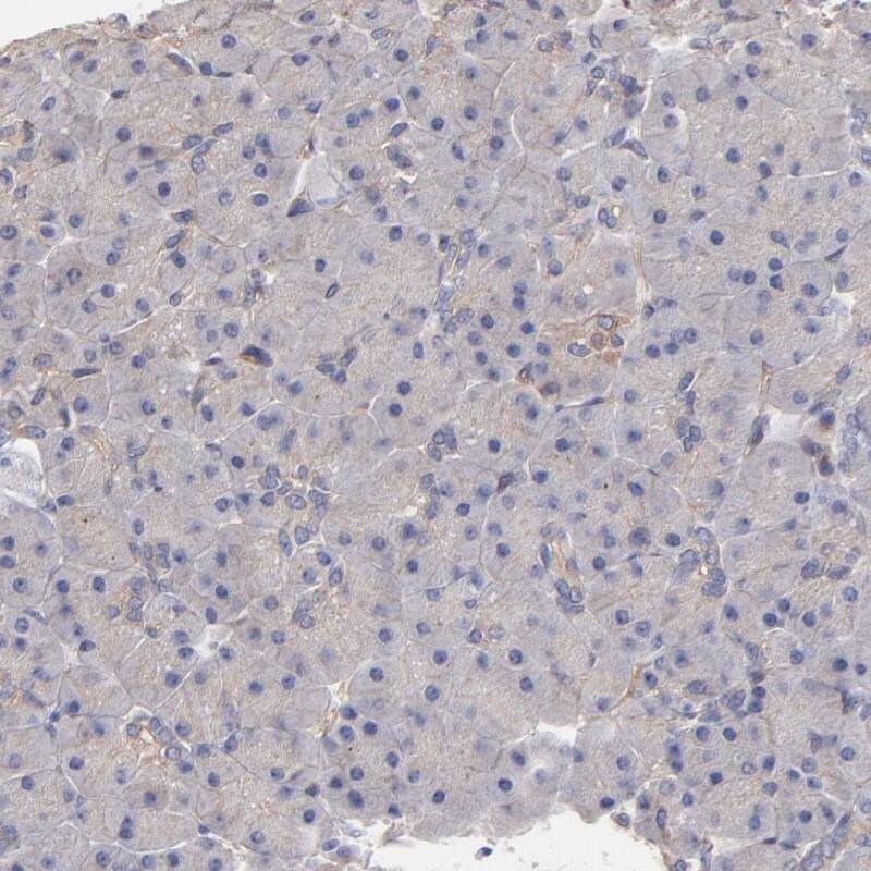 ASB7 Antibody - BSA Free Immunohistochemistry-Paraffin: ASB7 Antibody - BSA Free [NBP1-86157]