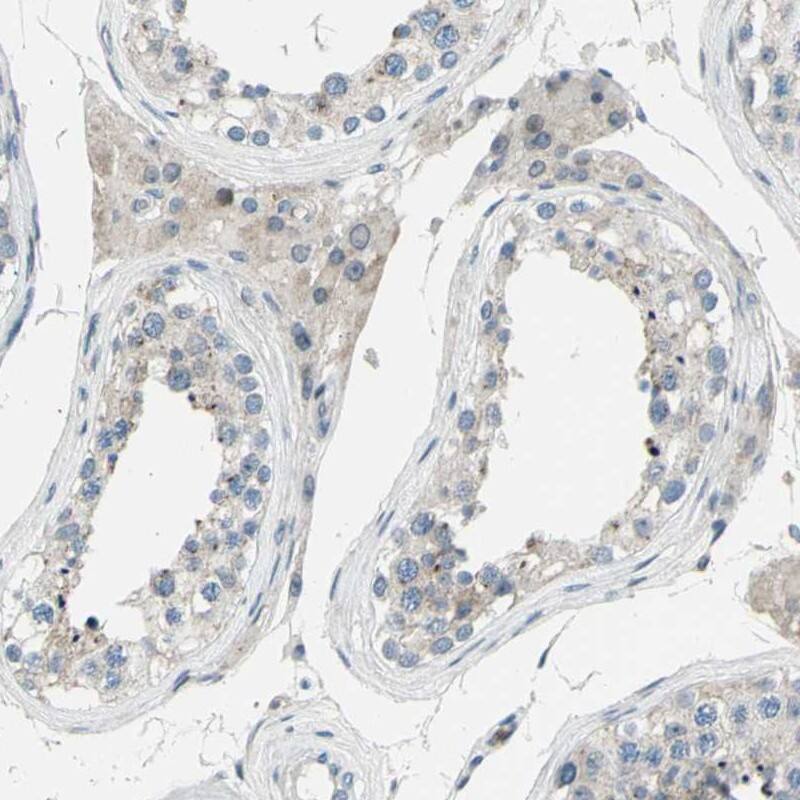 ZNF184 Antibody - BSA Free Immunohistochemistry-Paraffin: ZNF184 Antibody - BSA Free [NBP1-86159]