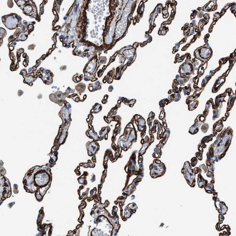 NAB1 Antibody - BSA Free Immunohistochemistry-Paraffin: NAB1 Antibody - BSA Free [NBP1-86163]