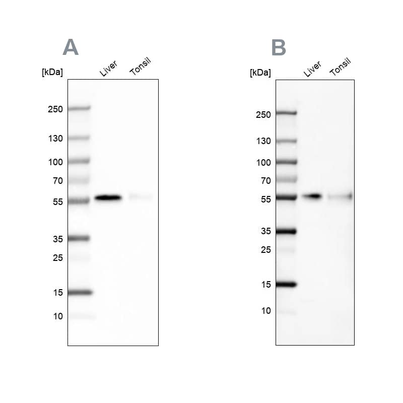 CD14 Antibody - BSA Free Western Blot: CD14 Antibody - BSA Free [NBP1-86166]