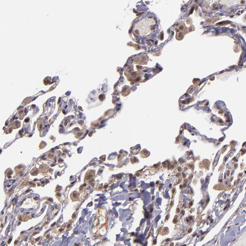 USP51 Antibody - BSA Free Immunohistochemistry-Paraffin: USP51 Antibody - BSA Free [NBP1-86167]