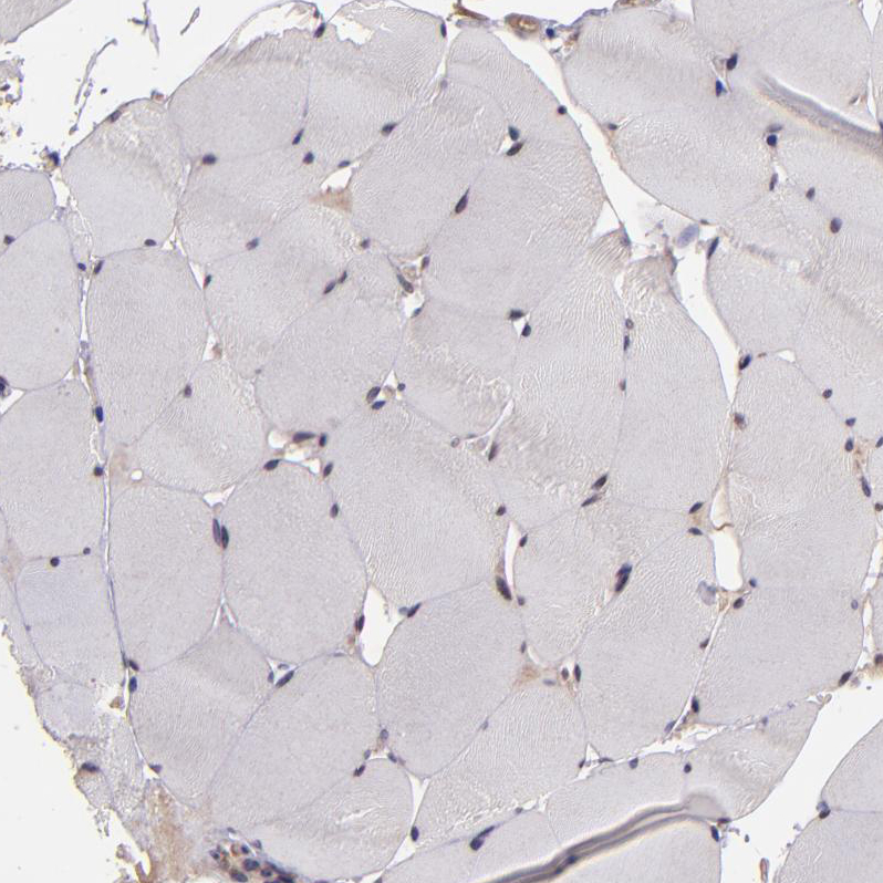 USP51 Antibody - BSA Free Immunohistochemistry-Paraffin: USP51 Antibody - BSA Free [NBP1-86167]
