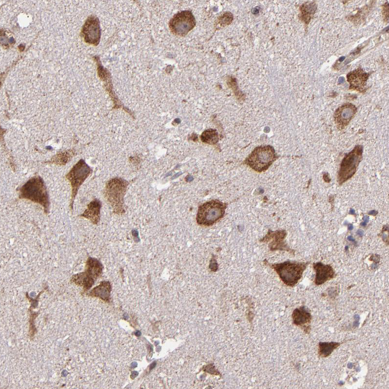 USP51 Antibody - BSA Free Immunohistochemistry-Paraffin: USP51 Antibody - BSA Free [NBP1-86167]