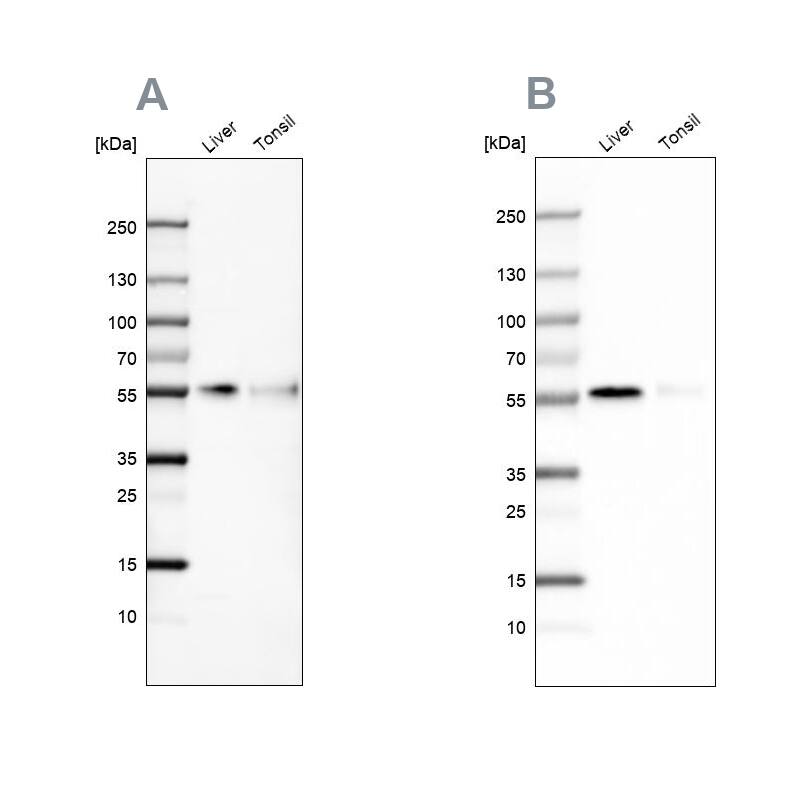 CD14 Antibody - BSA Free Western Blot: CD14 Antibody - BSA Free [NBP1-86168]