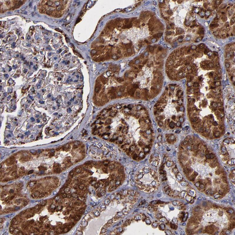 SOD2/Mn-SOD Antibody - BSA Free Immunohistochemistry-Paraffin: SOD2/Mn-SOD Antibody - BSA Free [NBP1-86169]