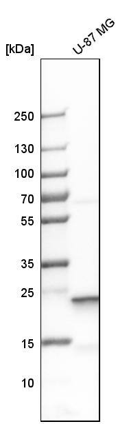 SOD2/Mn-SOD Antibody - BSA Free Western Blot: SOD2/Mn-SOD Antibody - BSA Free [NBP1-86169]