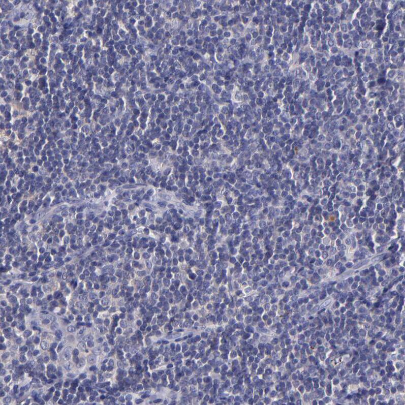 RBP4/Retinol-Binding Protein 4 Antibody - BSA Free Immunohistochemistry-Paraffin: RBP4/Retinol-Binding Protein 4 Antibody - BSA Free [NBP1-86173]