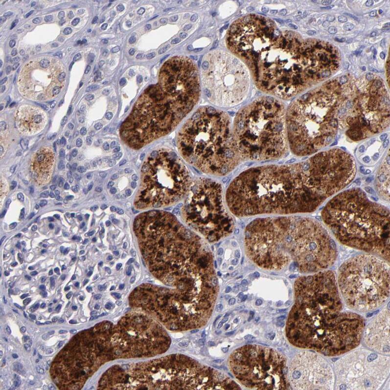 RBP4/Retinol-Binding Protein 4 Antibody - BSA Free Immunohistochemistry-Paraffin: RBP4/Retinol-Binding Protein 4 Antibody - BSA Free [NBP1-86173]