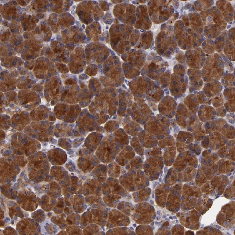 SYTL4 Antibody - BSA Free Immunohistochemistry-Paraffin: SYTL4 Antibody - BSA Free [NBP1-86176]