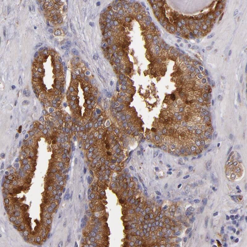SYTL4 Antibody - BSA Free Immunohistochemistry-Paraffin: SYTL4 Antibody - BSA Free [NBP1-86176]