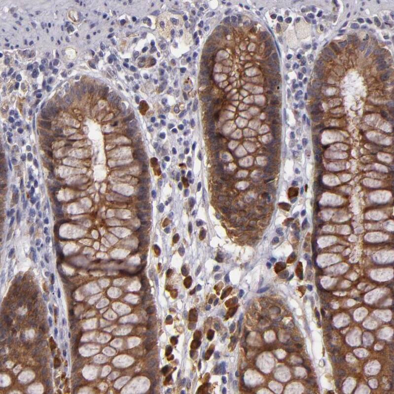 SYTL4 Antibody - BSA Free Immunohistochemistry-Paraffin: SYTL4 Antibody - BSA Free [NBP1-86176]