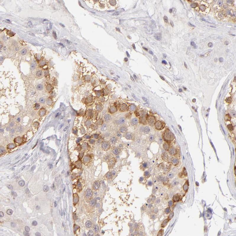IMP Dehydrogenase 2/IMPDH2 Antibody - BSA Free Immunohistochemistry-Paraffin: IMP Dehydrogenase 2/IMPDH2 Antibody - BSA Free [NBP1-86177]
