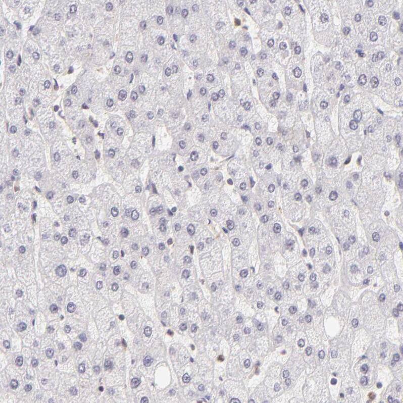 IMP Dehydrogenase 2/IMPDH2 Antibody - BSA Free Immunohistochemistry-Paraffin: IMP Dehydrogenase 2/IMPDH2 Antibody - BSA Free [NBP1-86177]