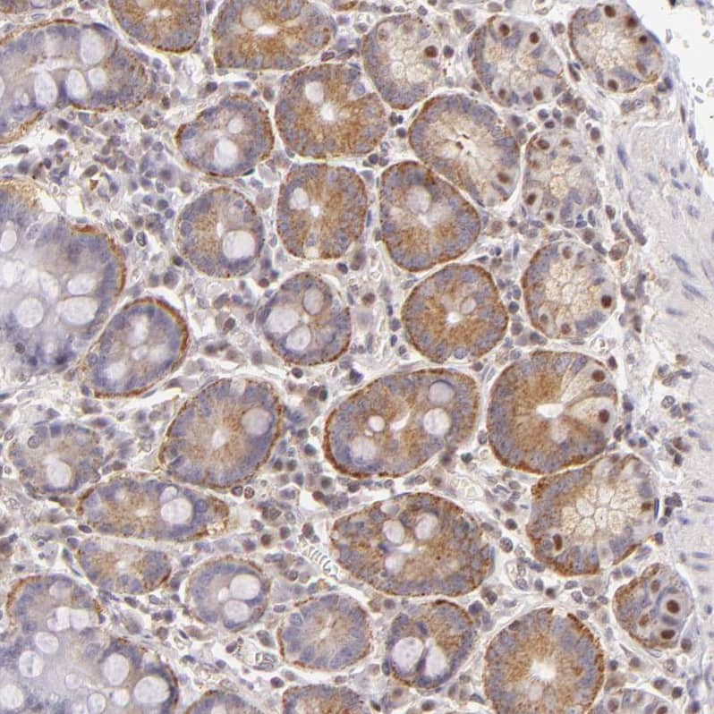 IMP Dehydrogenase 2/IMPDH2 Antibody - BSA Free Immunohistochemistry-Paraffin: IMP Dehydrogenase 2/IMPDH2 Antibody - BSA Free [NBP1-86177]