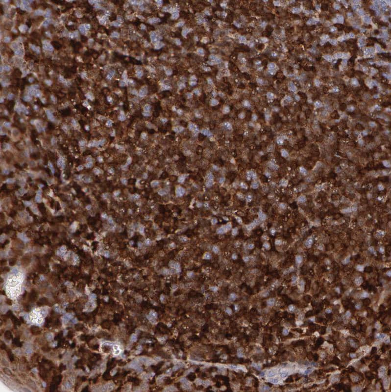 SYK Antibody - BSA Free Immunohistochemistry-Paraffin: SYK Antibody - BSA Free [NBP1-86178]