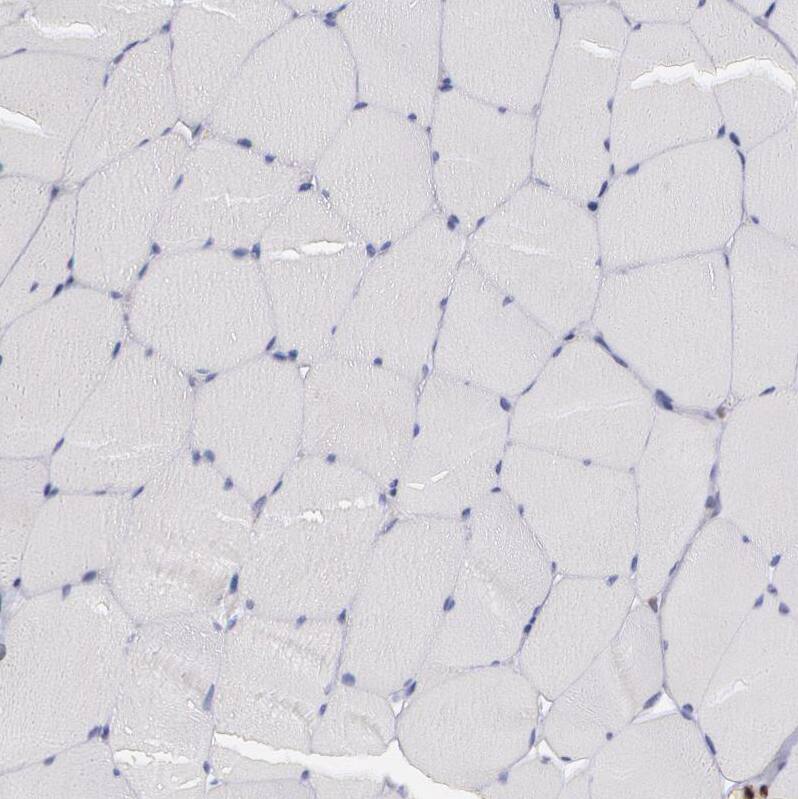 SYK Antibody - BSA Free Immunohistochemistry-Paraffin: SYK Antibody - BSA Free [NBP1-86178]