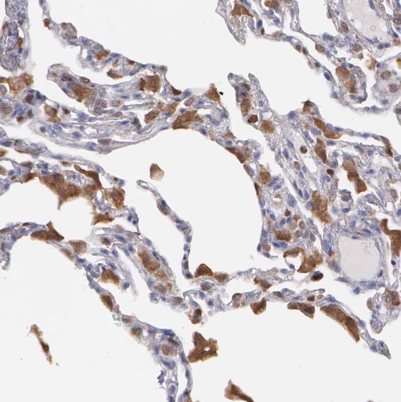 SYK Antibody - BSA Free Immunohistochemistry-Paraffin: SYK Antibody - BSA Free [NBP1-86178]