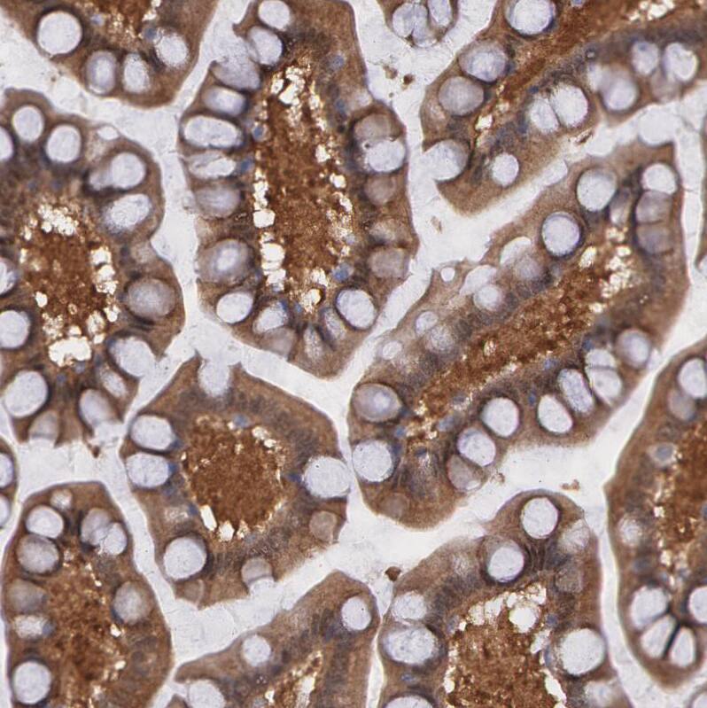 SYK Antibody - BSA Free Immunohistochemistry-Paraffin: SYK Antibody - BSA Free [NBP1-86178]