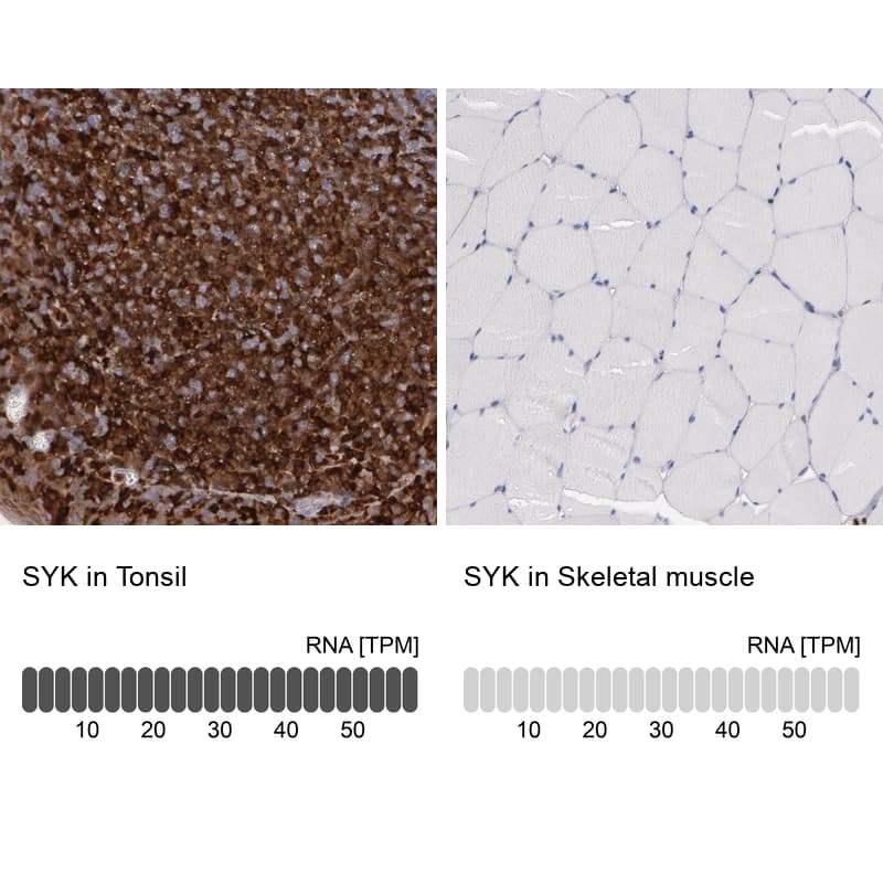 SYK Antibody - BSA Free Immunohistochemistry-Paraffin: SYK Antibody - BSA Free [NBP1-86178]