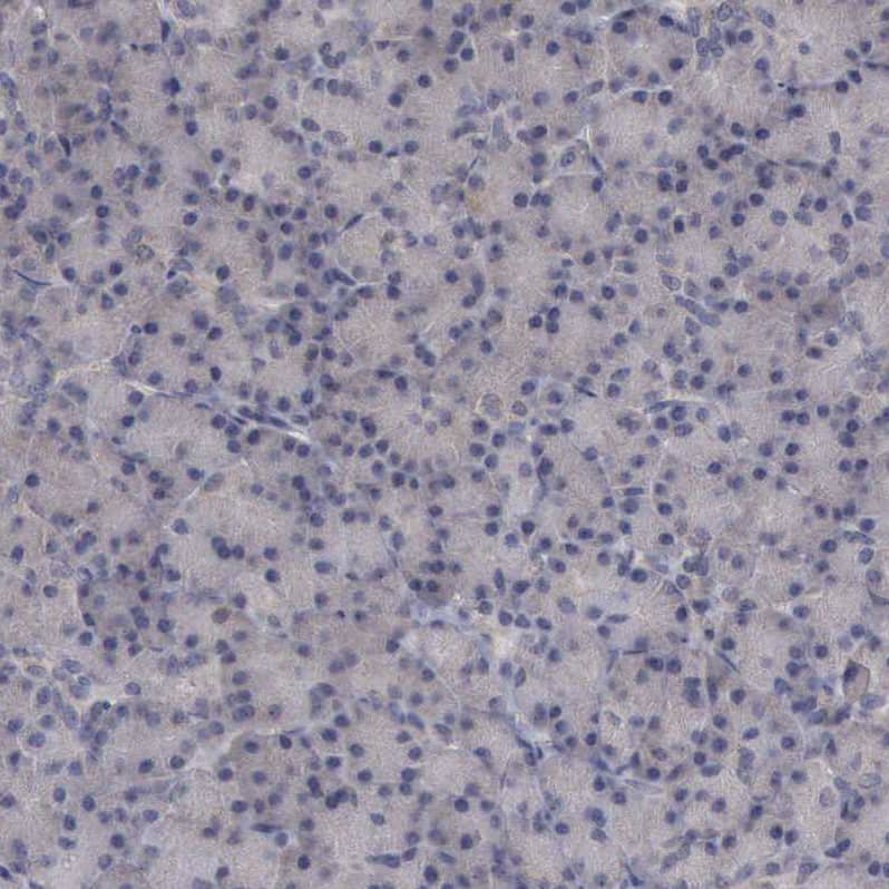 CrkL Antibody - BSA Free Immunohistochemistry-Paraffin: CrkL Antibody - BSA Free [NBP1-86181]