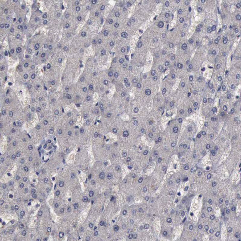 CrkL Antibody - BSA Free Immunohistochemistry-Paraffin: CrkL Antibody - BSA Free [NBP1-86181]