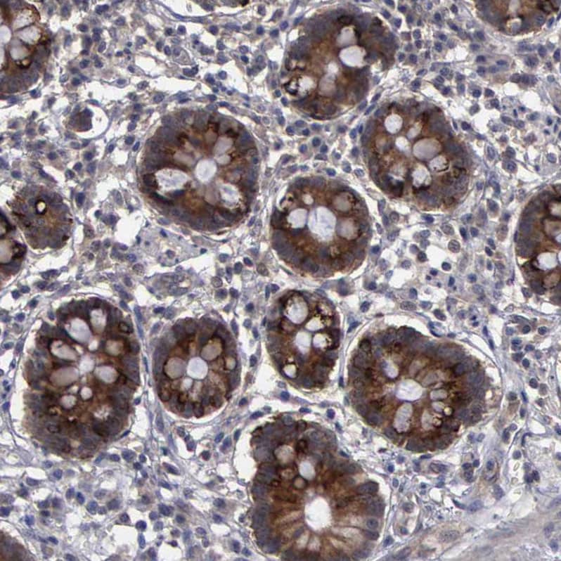 CrkL Antibody - BSA Free Immunohistochemistry-Paraffin: CrkL Antibody - BSA Free [NBP1-86181]
