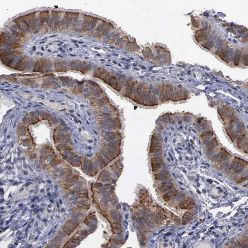 CrkL Antibody - BSA Free Immunohistochemistry-Paraffin: CrkL Antibody - BSA Free [NBP1-86181]