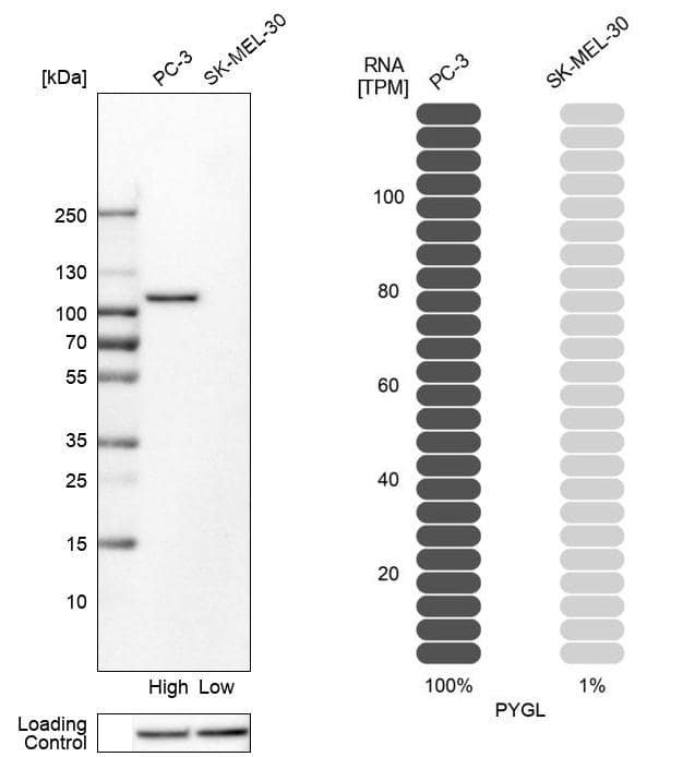 PYGL Antibody - BSA Free Western Blot: PYGL Antibody - BSA Free [NBP1-86182]