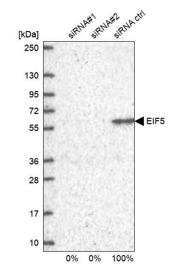 EIF5 Antibody - BSA Free Western Blot: EIF5 Antibody - BSA Free [NBP1-86184]