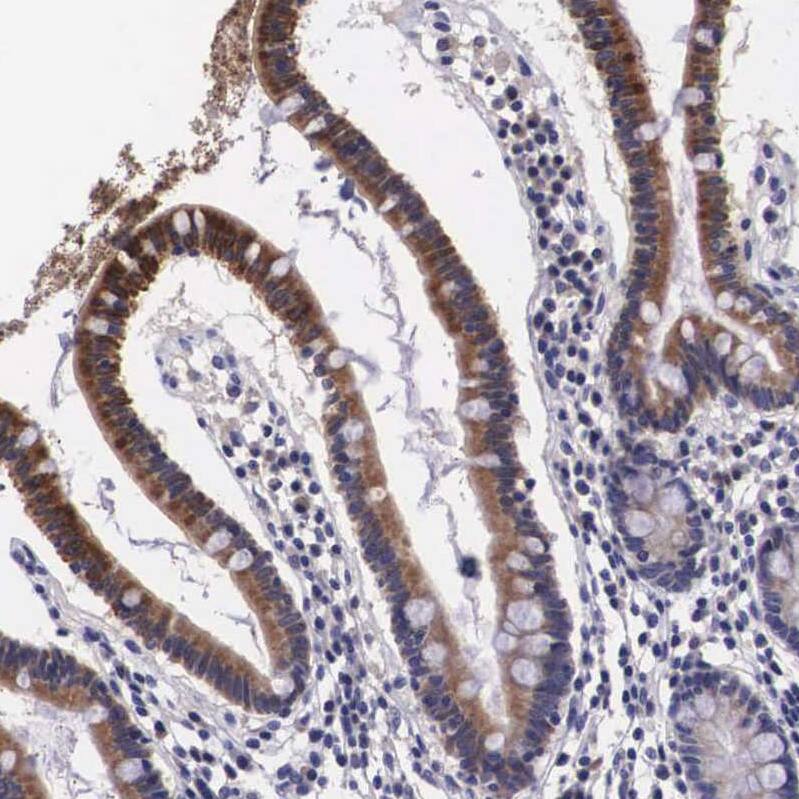 ARG2 Antibody - BSA Free Immunohistochemistry-Paraffin: ARG2 Antibody - BSA Free [NBP1-86189]