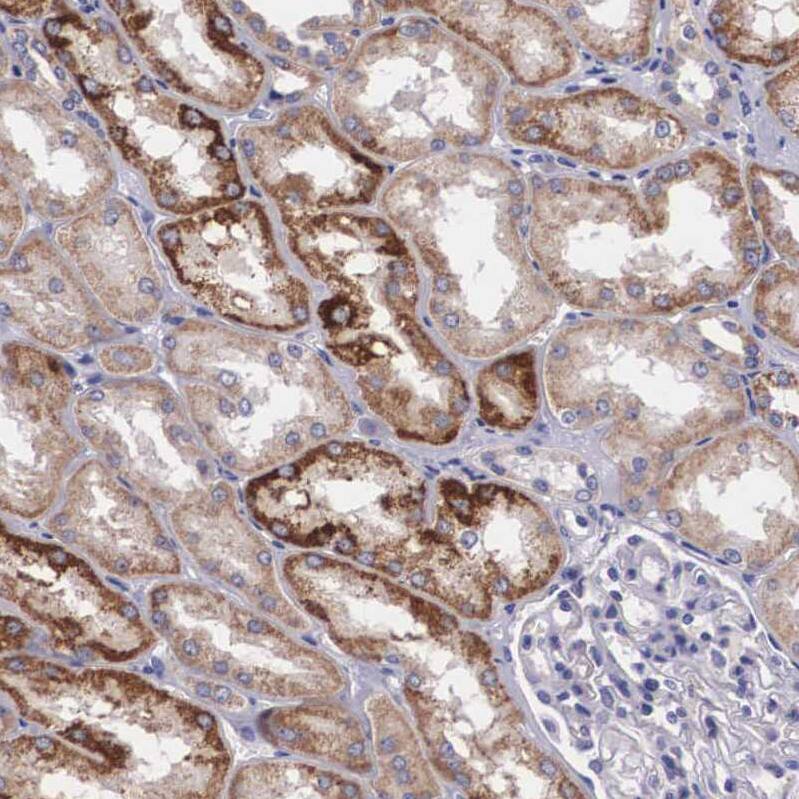 ARG2 Antibody - BSA Free Immunohistochemistry-Paraffin: ARG2 Antibody - BSA Free [NBP1-86189]