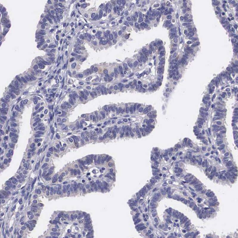 ARG2 Antibody - BSA Free Immunohistochemistry-Paraffin: ARG2 Antibody - BSA Free [NBP1-86189]