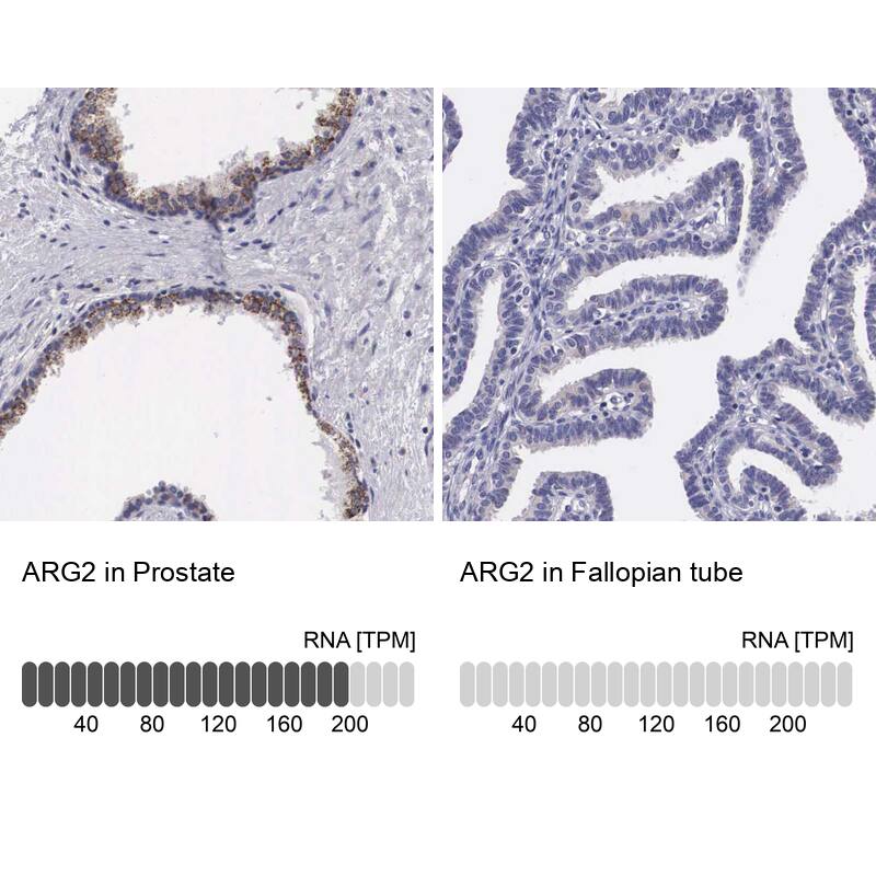 ARG2 Antibody - BSA Free Immunohistochemistry-Paraffin: ARG2 Antibody - BSA Free [NBP1-86189]