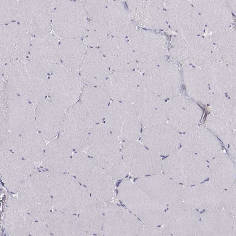 ZNF185 Antibody - BSA Free Immunohistochemistry-Paraffin: ZNF185 Antibody - BSA Free [NBP1-86192]