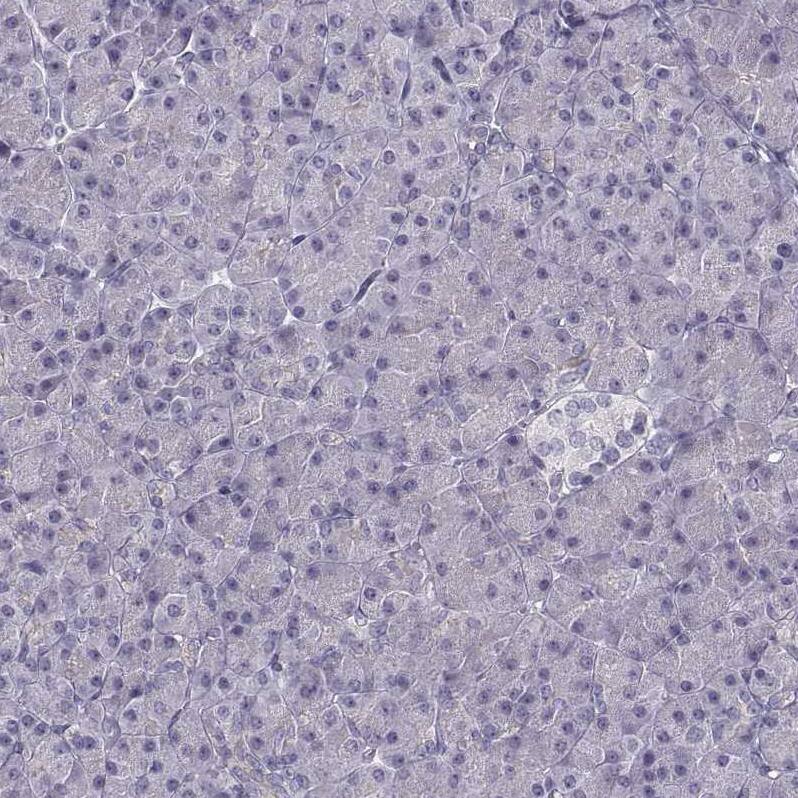 ZNF185 Antibody - BSA Free Immunohistochemistry-Paraffin: ZNF185 Antibody - BSA Free [NBP1-86192]