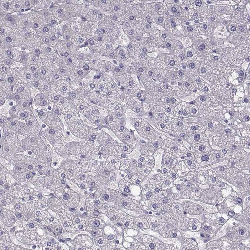 ZNF185 Antibody - BSA Free Immunohistochemistry-Paraffin: ZNF185 Antibody - BSA Free [NBP1-86192]