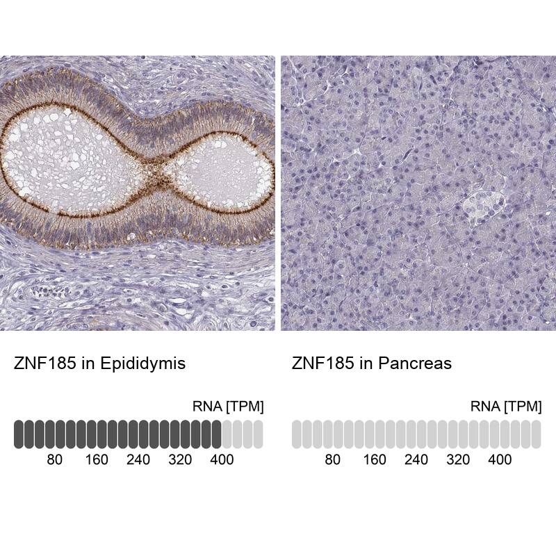 ZNF185 Antibody - BSA Free Immunohistochemistry-Paraffin: ZNF185 Antibody - BSA Free [NBP1-86192]