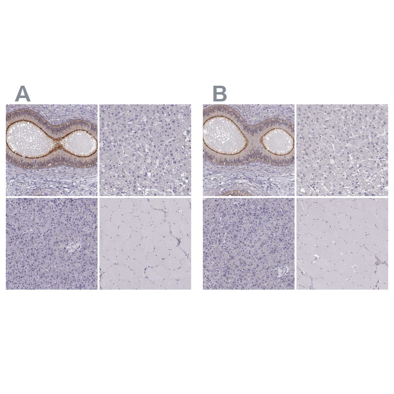 ZNF185 Antibody - BSA Free Immunohistochemistry-Paraffin: ZNF185 Antibody - BSA Free [NBP1-86192]
