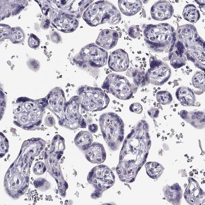 ADAM32 Antibody - BSA Free Immunohistochemistry-Paraffin: ADAM32 Antibody - BSA Free [NBP1-86198]