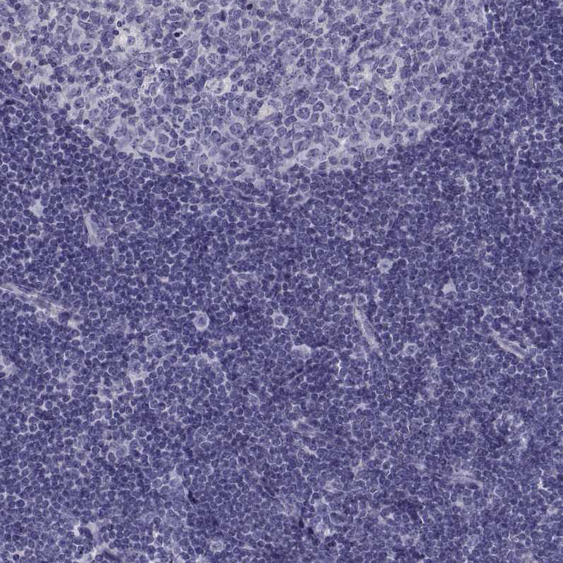 ADAM32 Antibody - BSA Free Immunohistochemistry-Paraffin: ADAM32 Antibody - BSA Free [NBP1-86198]