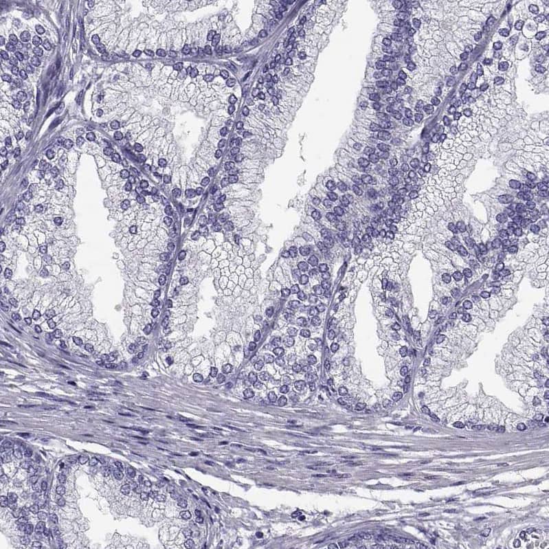 ADAM32 Antibody - BSA Free Immunohistochemistry-Paraffin: ADAM32 Antibody - BSA Free [NBP1-86198]