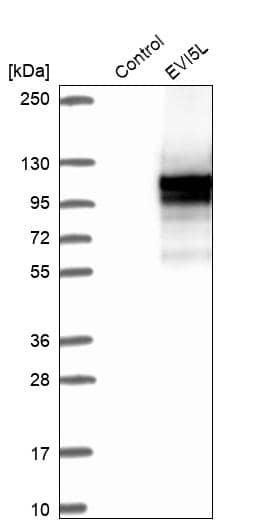 EVI5L Antibody - BSA Free Western Blot: EVI5L Antibody - BSA Free [NBP1-86206]