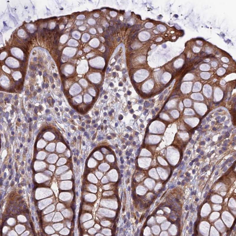 ADAMTS15 Antibody - BSA Free Immunohistochemistry-Paraffin: ADAMTS15 Antibody - BSA Free [NBP1-86209]