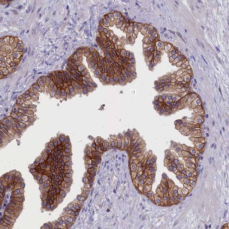 COL19A1 Antibody - BSA Free Immunohistochemistry-Paraffin: COL19A1 Antibody - BSA Free [NBP1-86215]