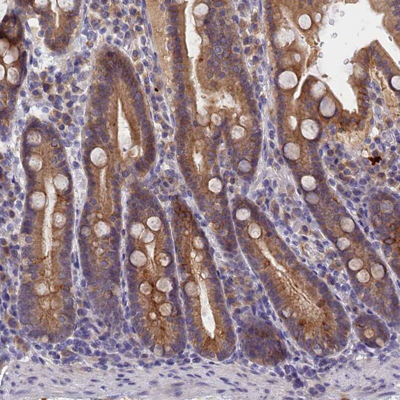 COL19A1 Antibody - BSA Free Immunohistochemistry-Paraffin: COL19A1 Antibody - BSA Free [NBP1-86215]