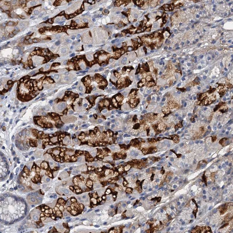 THAP10 Antibody - BSA Free Immunohistochemistry-Paraffin: THAP10 Antibody [NBP1-86226]