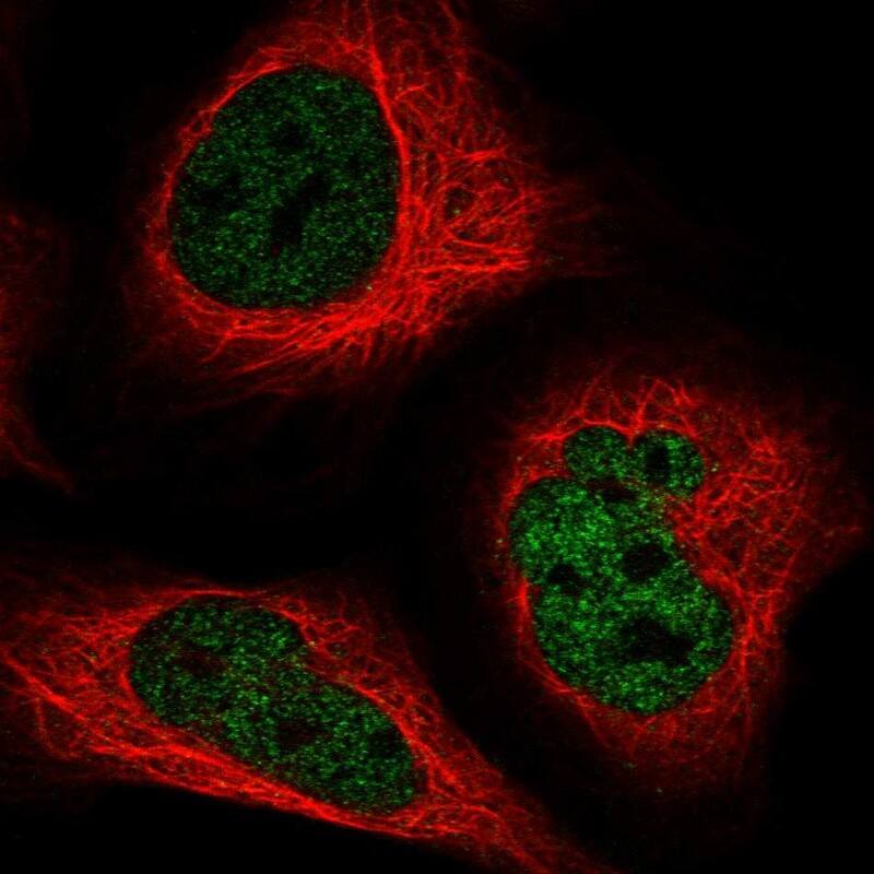 ADAT1 Antibody - BSA Free Immunocytochemistry/ Immunofluorescence: ADAT1 Antibody [NBP1-86237]